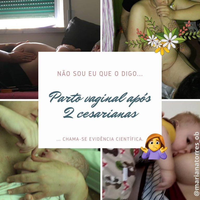 Parto Vaginal Após 2 Cesarianas Mariana Torres Ob 