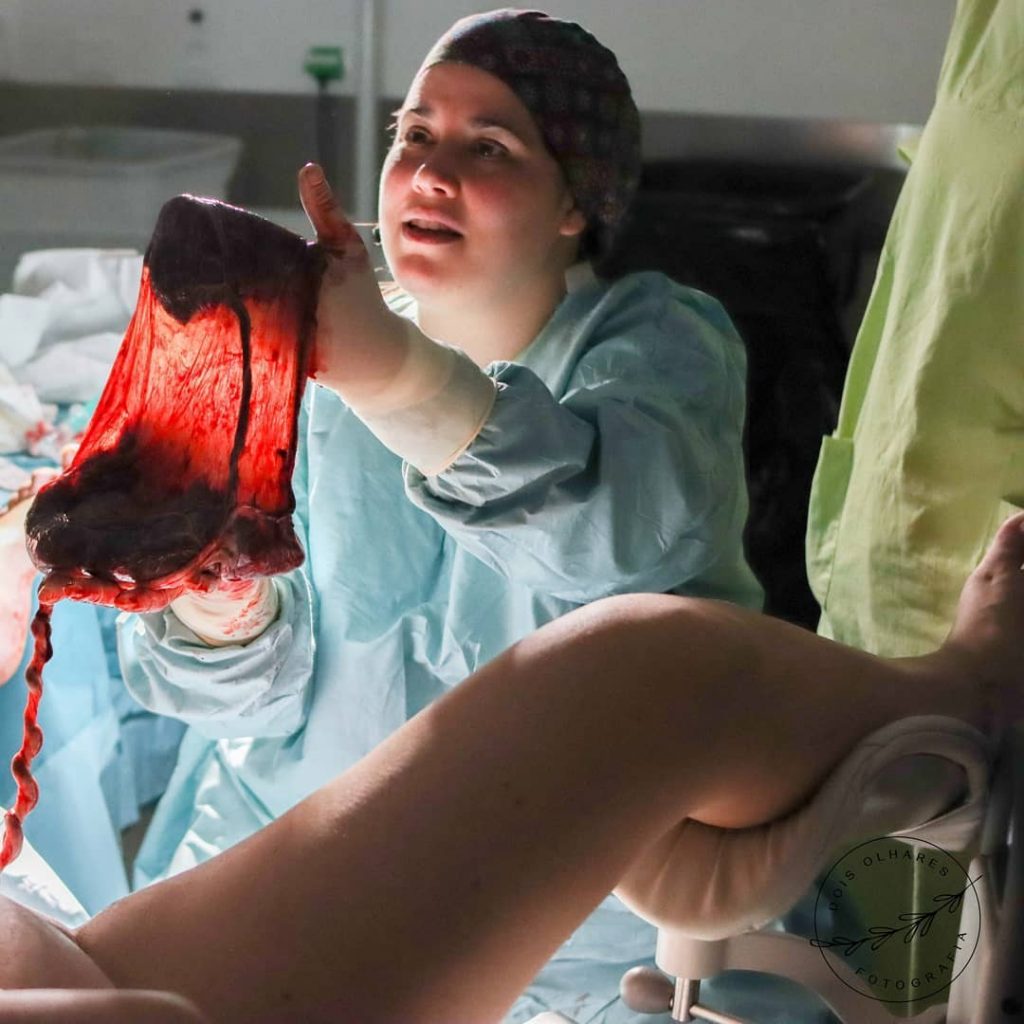 obstetra a mostrar a placenta apos o parto