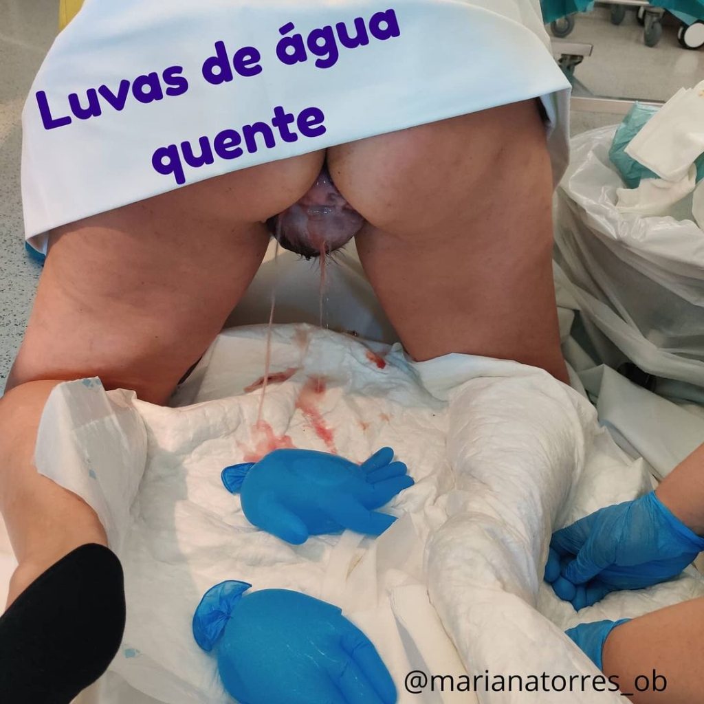 luvas de água quente no parto
