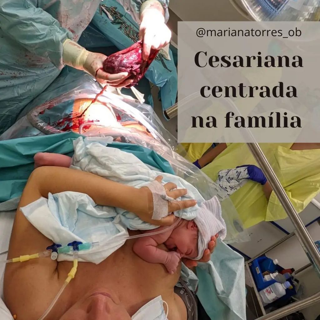 cesariana centrada na familia, contacto pele a pele, placenta