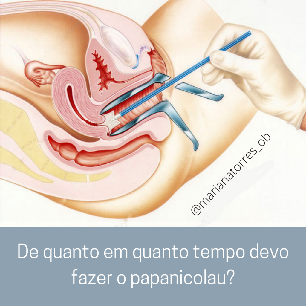 colheita citologia cervical