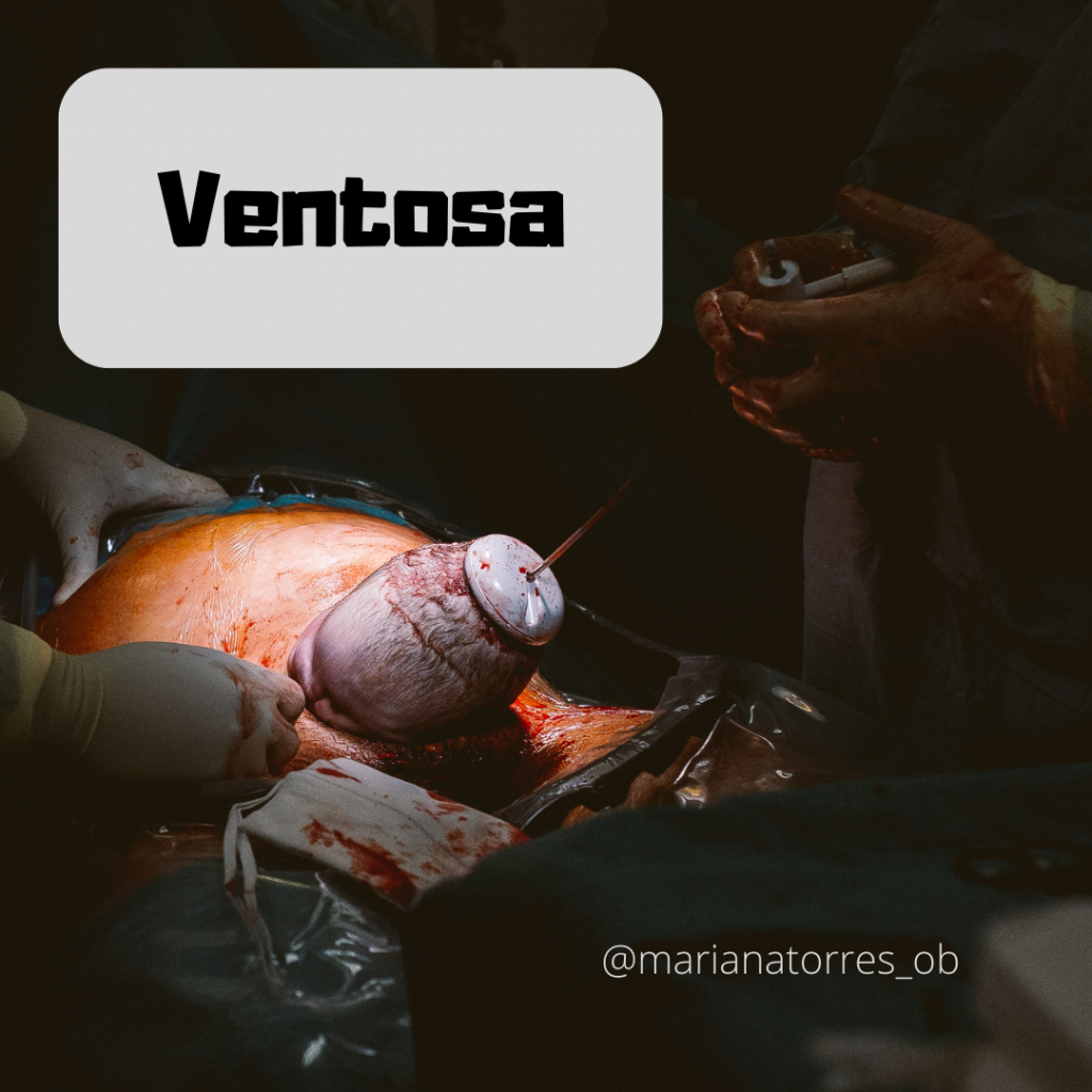 ventosa durante cesariana